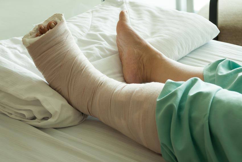 A person laying in bed with a cast on their left leg