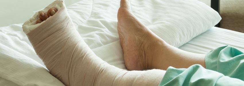 A person laying in bed with a cast on their left leg